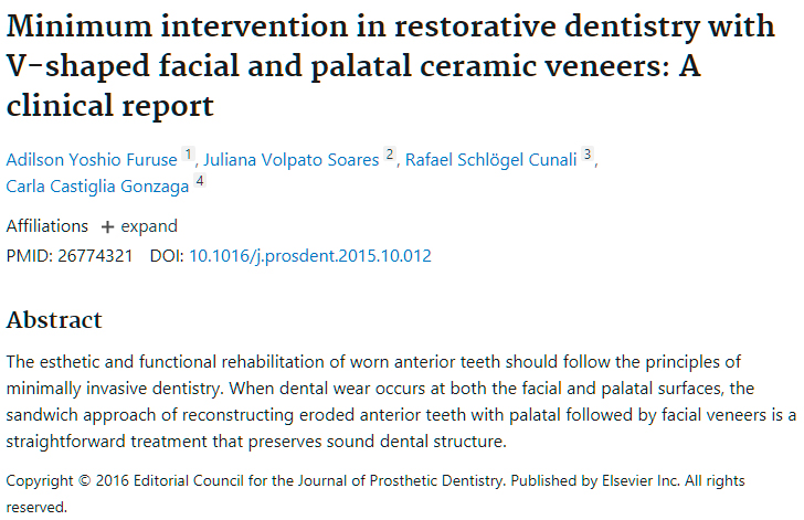 Minimum intervention in restorative dentistry with V-shaped facial and palatal ceramic veneers: A clinical report