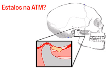 Estalos na ATM?